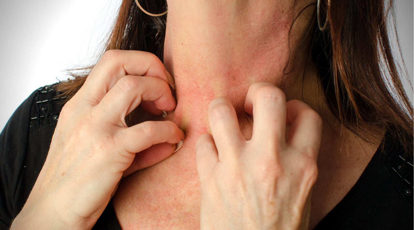 Jewelry Question: What Metals Are Hypoallergenic?